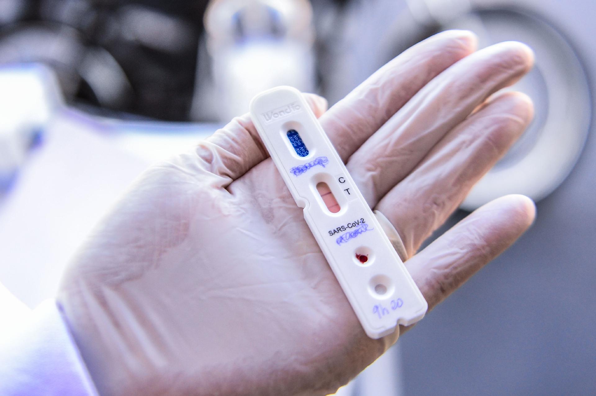 Testes rápidos de Covid-19 em farmácias ultrapassam marca de dois milhões