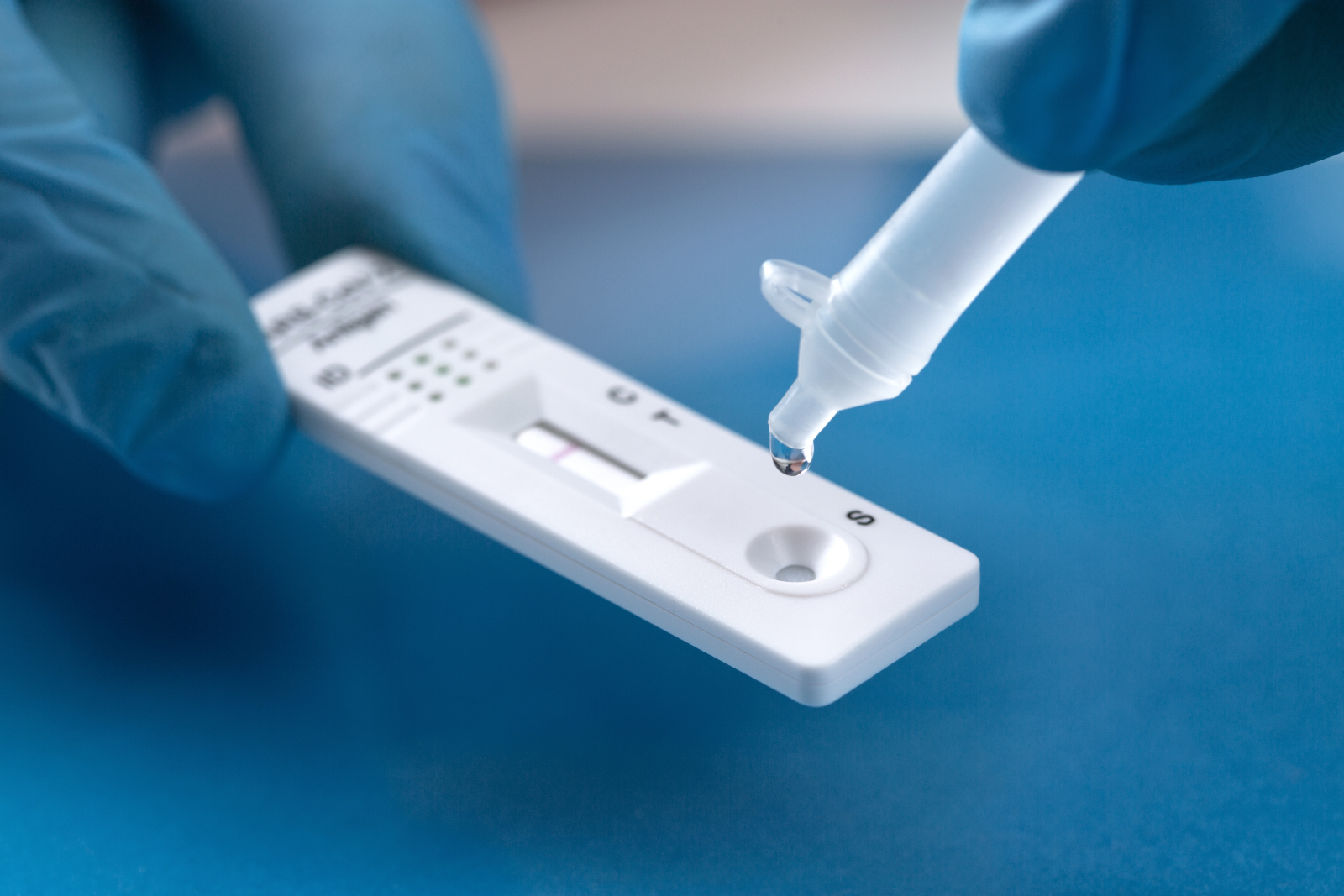Anvisa aprova minuta de RDC que autoriza testes rápidos em farmácias e drogarias