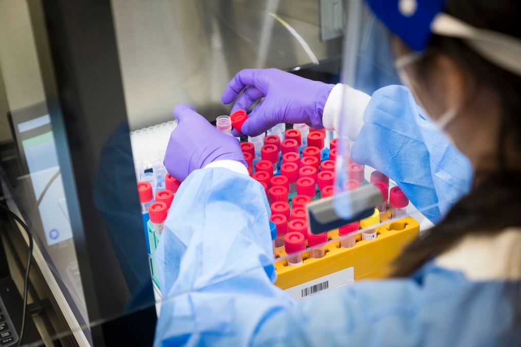 Diagnóstico molecular marca nova era no cuidado com a saúde da mulher
